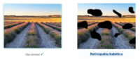 retinopatia-diabetica-2