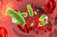 1368_sepsis
