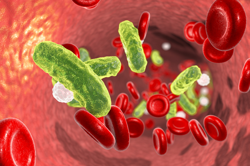 1368_sepsis