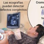 Síndrome de Patau: Causas, Síntomas y Diagnóstico