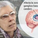 Enfermedad de Huntington: Trastorno Neurodegenerativo Hereditario