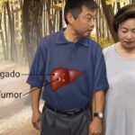 Cáncer de Hígado