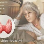 Hipotiroidismo: una afección común de la tiroides