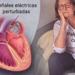 Fibrilación auricular: alteración del ritmo cardíaco