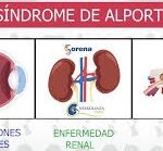 Síndrome de Alport