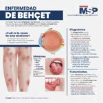 Enfermedad de Behçet