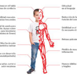 Distrofia Muscular de Duchenne (DMD)