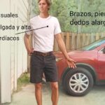 Síndrome de Marfan: resumen informativo