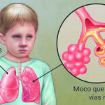 Fibrosis Quística