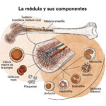 Síndrome Mielodisplásico: un trastorno de la médula ósea que afecta la producción de sangre