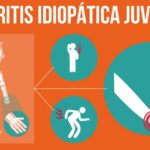Artritis Idiopática Juvenil: una enfermedad inflamatoria que afecta a niños y adolescentes