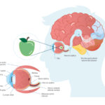 Neuromielitis óptica: una enfermedad autoinmune que afecta la médula espinal y los nervios ópticos