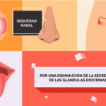 Síndrome de Sjögren: explicación clínica detallada