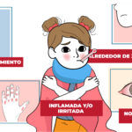 Enfermedad de Kawasaki