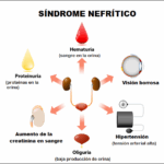 Síndrome nefrítico