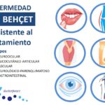 Enfermedad de Behçet