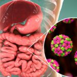 Norovirus: una revisión científica integral