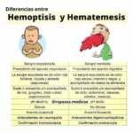Hemoptisis recurrente: explicación médica completa