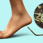 TÉTANOS — EXPLICACIÓN COMPLETA