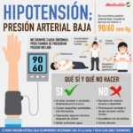 HIPOTENSIÓN