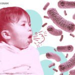 Tos ferina (pertussis)