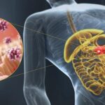 Gastroenteritis viral: causas, síntomas, tratamiento y prevención