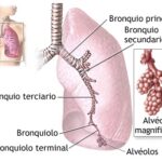 Edema pulmonar: acumulación patológica de líquido en los pulmones