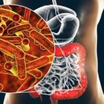 Shigelosis: una infección intestinal de alta transmisibilidad y relevancia en salud pública