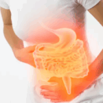 Síndrome de malabsorción