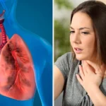 Insuficiencia Respiratoria: Concepto, Causas, Diagnóstico y Tratamiento