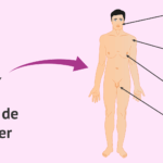 Síndrome de Klinefelter
