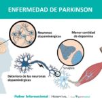 Enfermedad de Parkinson