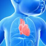 Cardiopatías Congénitas