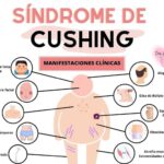 Síndrome de Cushing: Un Trastorno por Exceso de Cortisol