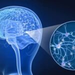 Esclerosis Múltiple: Una Enfermedad Neurológica Compleja