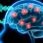 Epilepsia: una enfermedad neurológica que puede controlarse con un tratamiento adecuado