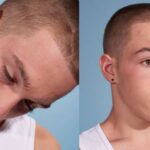 Narcolepsia: causas, síntomas, diagnóstico y tratamiento