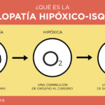 Encefalopatía: causas, síntomas, diagnóstico, tratamiento y prevención