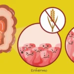 Intolerancia al gluten: causas, síntomas, diagnóstico y tratamiento