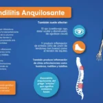 Espondilitis anquilosante: causas, síntomas, diagnóstico y tratamiento