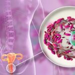 Vaginosis bacteriana: qué es, cuáles son sus síntomas y cómo se trata